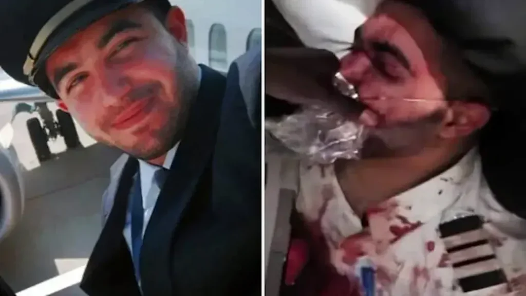 The image shows a pilot in uniform, first appearing in a professional setting and then in a distressed state with visible injuries and blood, suggesting a serious incident.